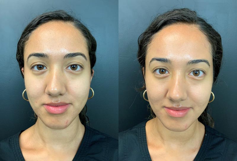 antes-y-despues-1