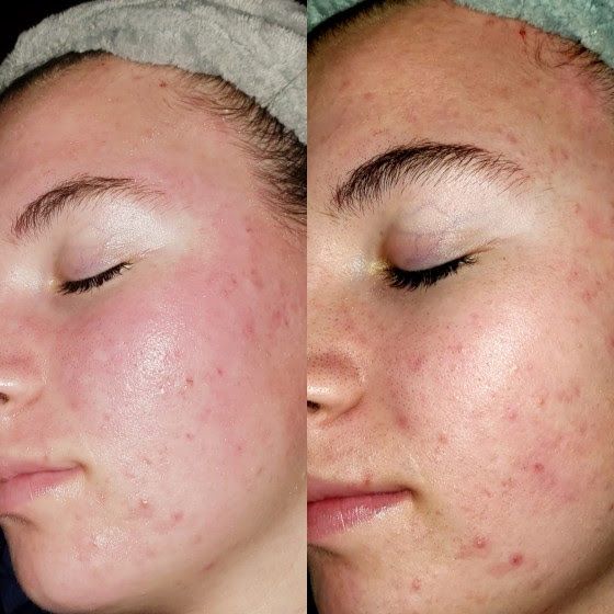 antes-y-despues-3